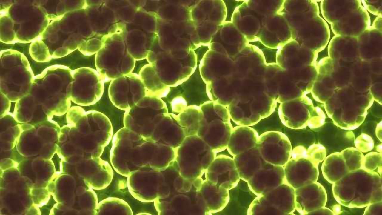 Peeling Off Pesky Biofilms