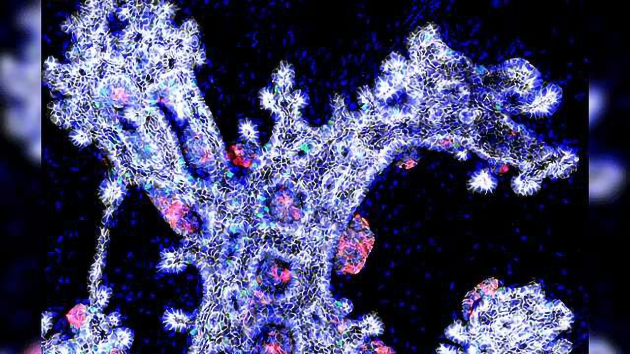 Next Step Towards Replacement Therapy in Type 1 Diabetes