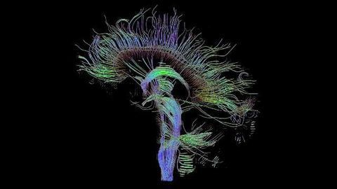 A Clearer Picture of Brain Scan Data