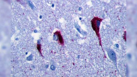 Pathological Tau Accumulates More in Excitatory, than Inhibitory, Neurons