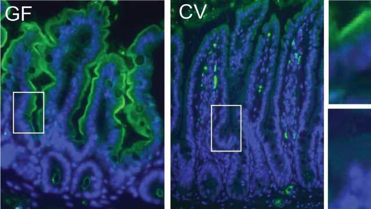 Microbiomes of Mice and Men