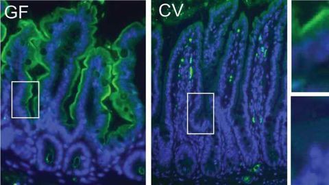 Microbiomes of Mice and Men