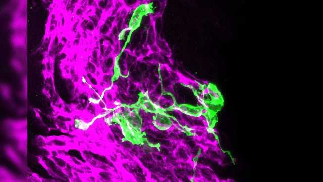 Aging Comes With Reduced Differentiation of Stem Cells into Olfactory Cells