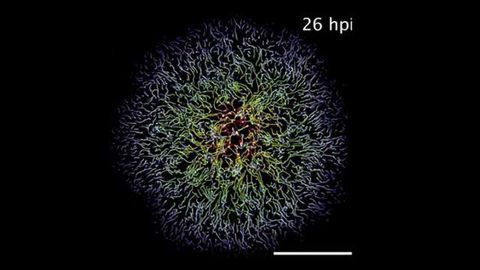 Watch Vaccinia Poxvirus Infect a Cell