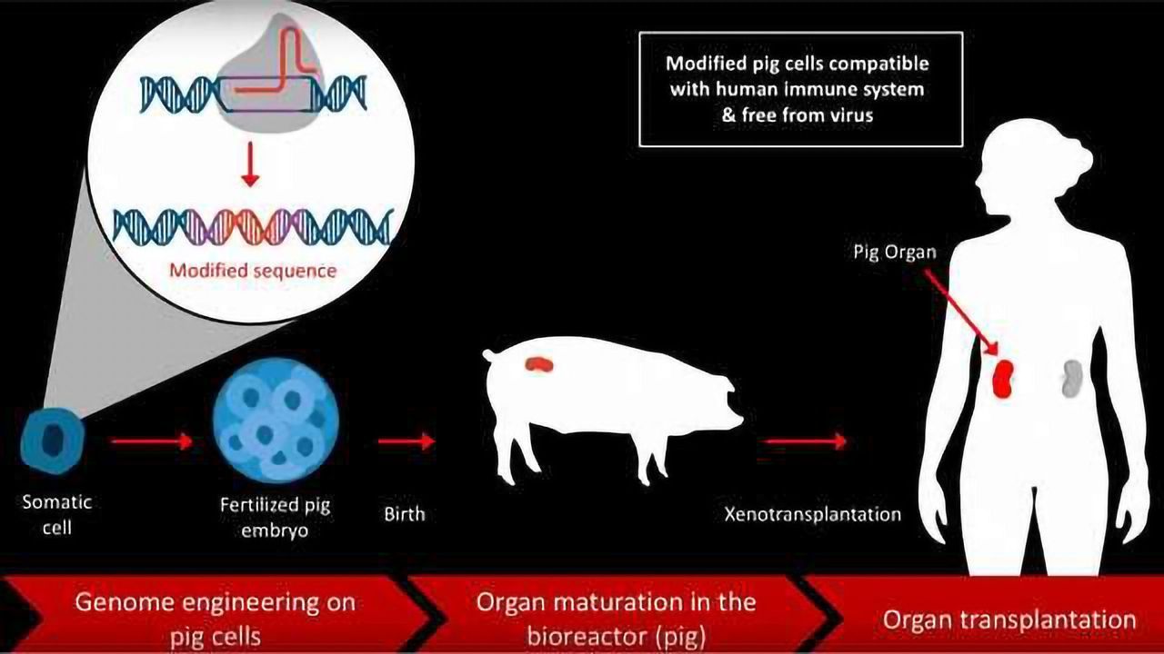 How to Create a World Where No One Dies Waiting for a Transplant