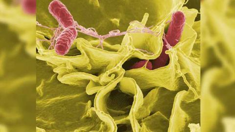 Bacteria-based Drug Delivery Could Radically Expand Cancer Treatment Options