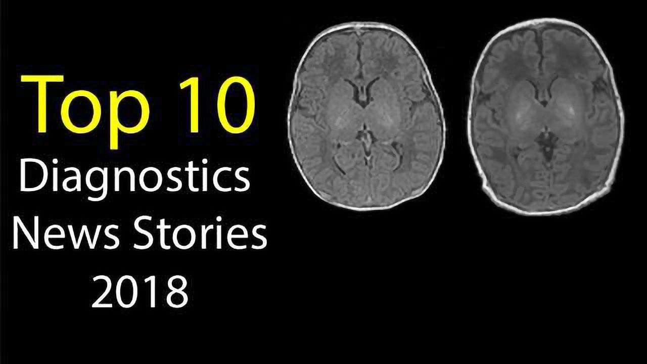 Top 10 Diagnostics News Stories of 2018