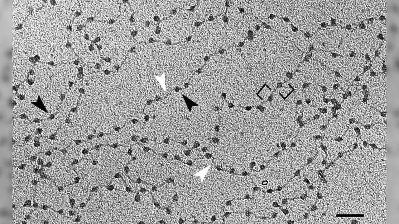 Cell-free DNA: a Biomarker of Aging?
