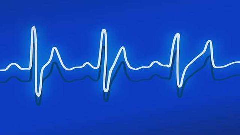 Sensor Tracks Heart Muscle Cells As They Beat