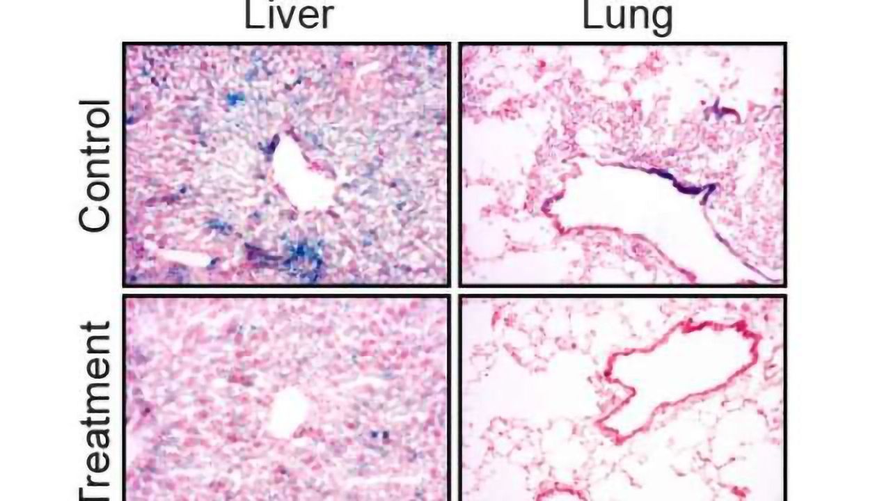 Immune System's Fountain of Youth