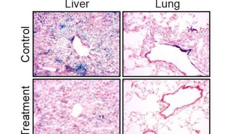 Immune System's Fountain of Youth