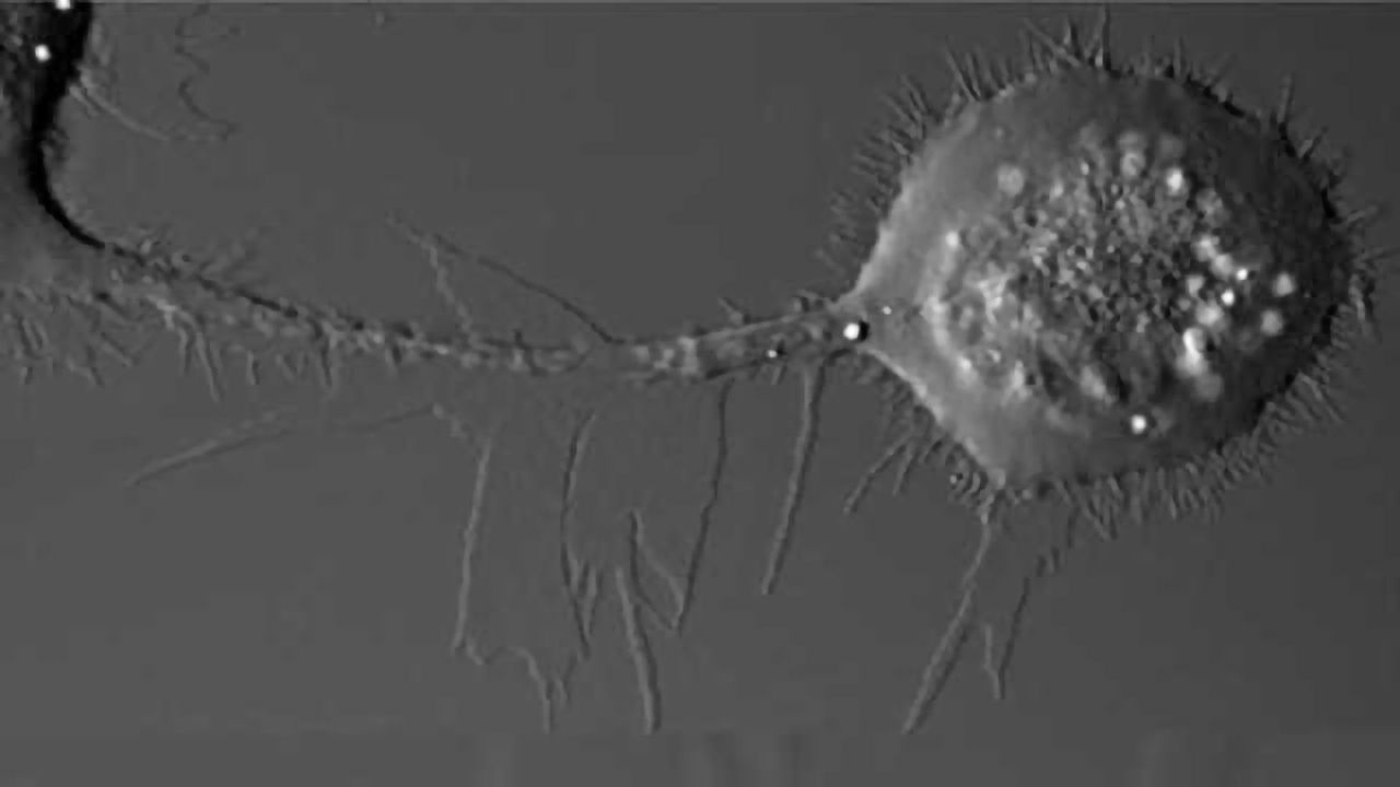 Breast Cancer Drugs Could Help Tackle Treatment-resistant Lung Cancers