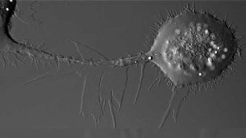 Breast Cancer Drugs Could Help Tackle Treatment-resistant Lung Cancers