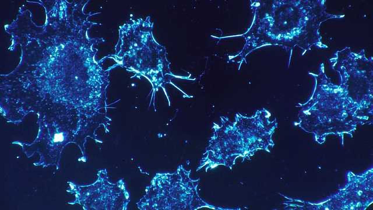 Tissue-resident Memory T Cells Survey Melanoma Cells