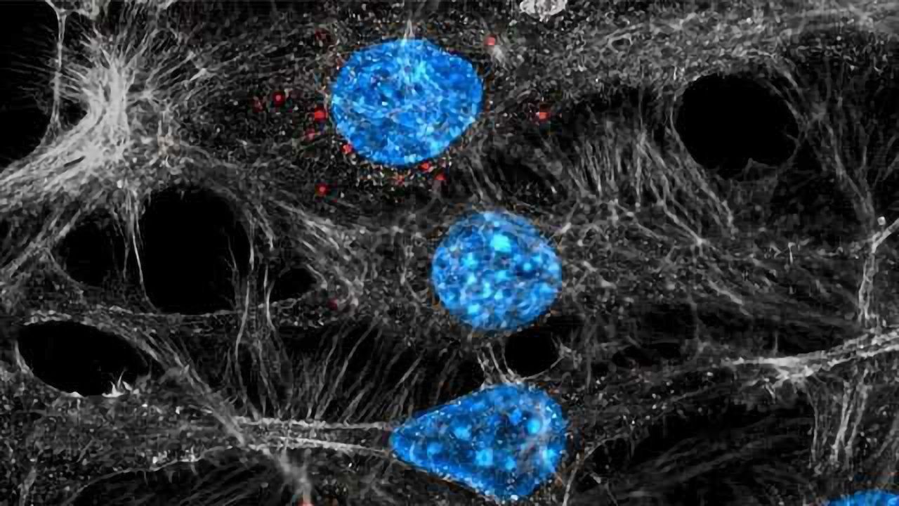 Tumors Backfire on Chemotherapy