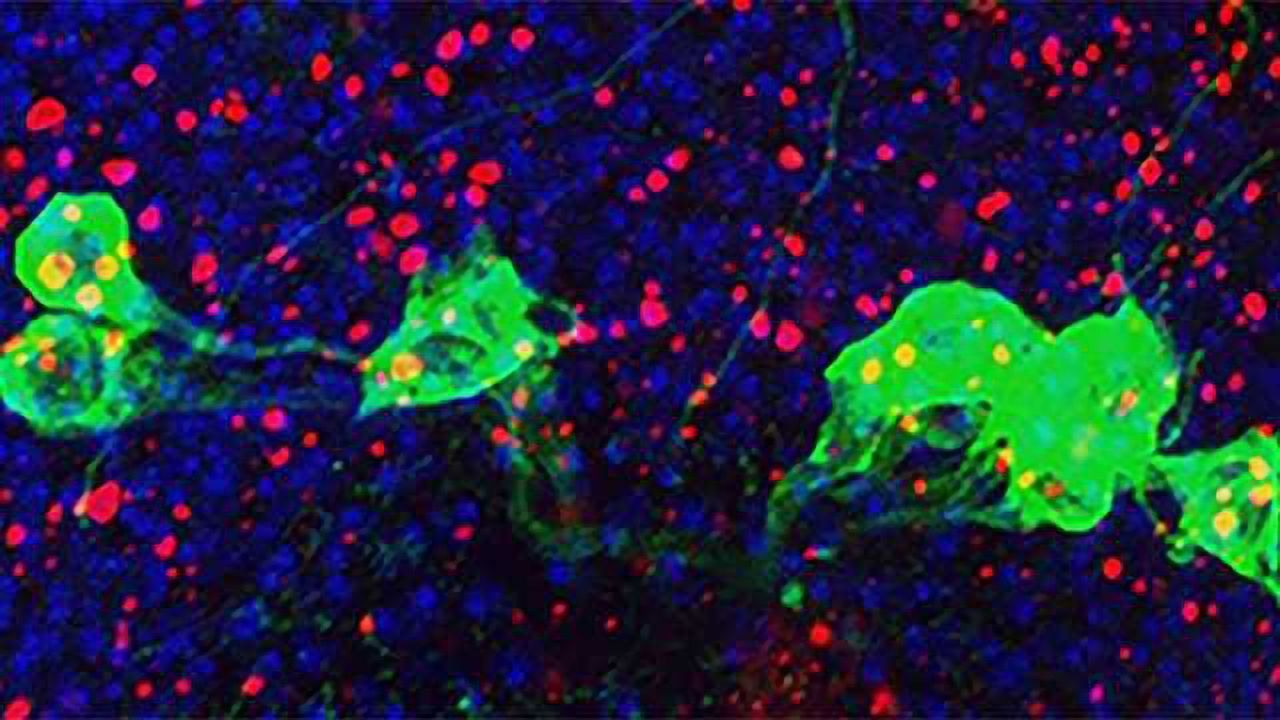 Overactive Immune System Implicated in Aging Brain Disorders