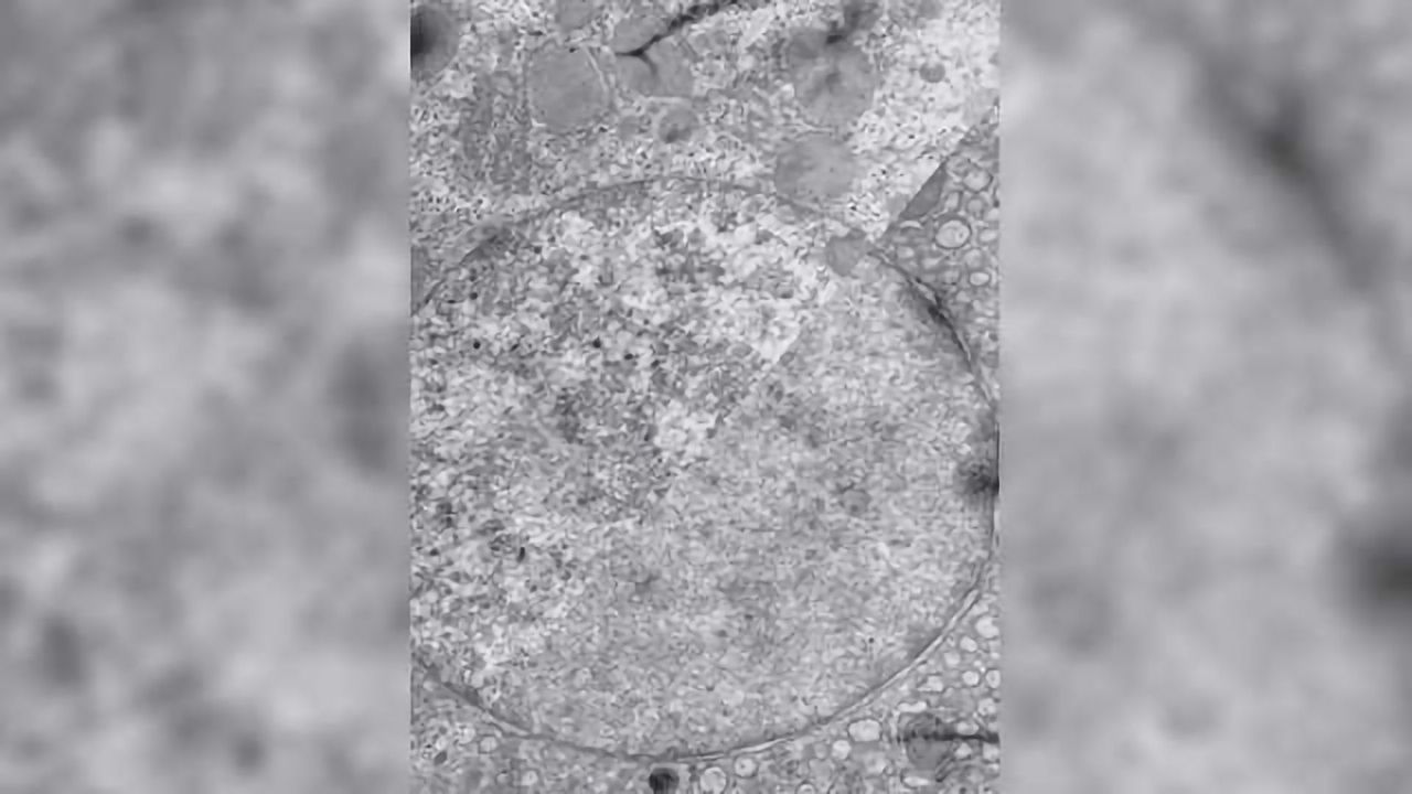 Pivotal Role for Heterochromatin During Cell Lineage Commitment