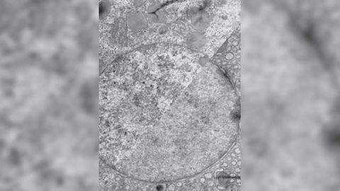 Pivotal Role for Heterochromatin During Cell Lineage Commitment
