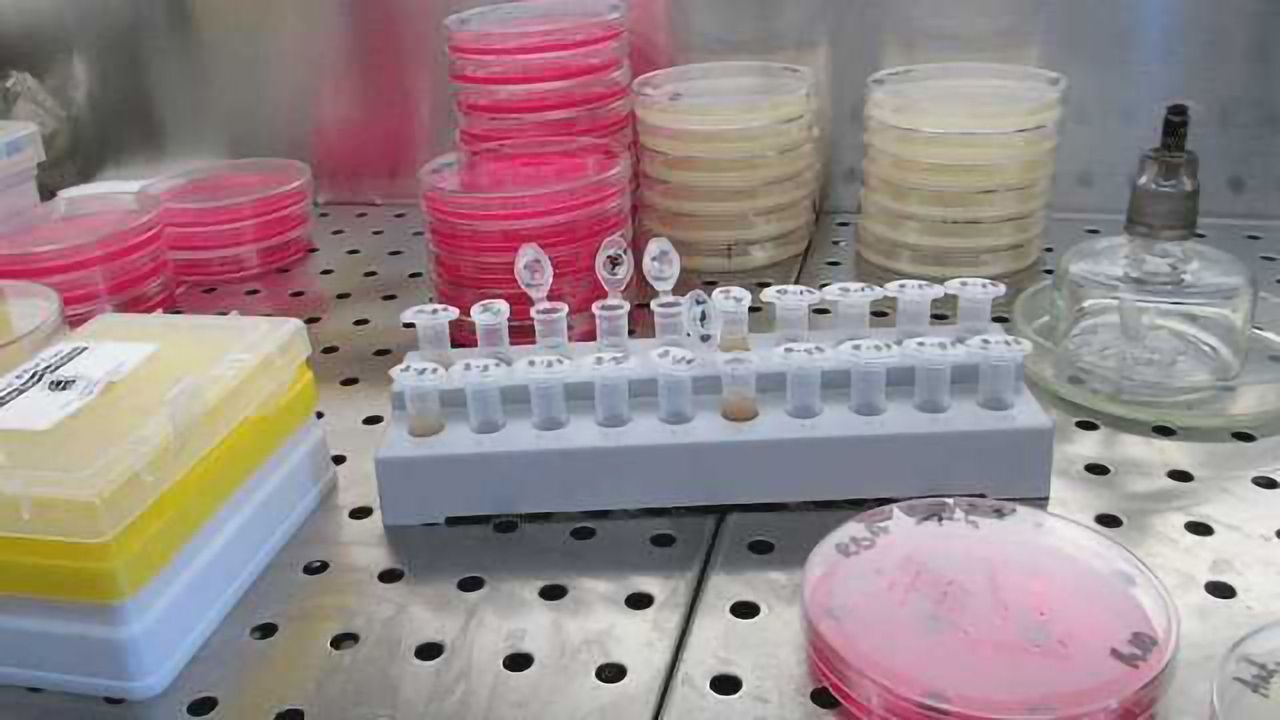 Active Surveillance vs Treatment in Prostate Cancer? Biomarkers Help Decide