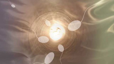 Compromised Sperm Quality Linked to Recurrent Miscarriage