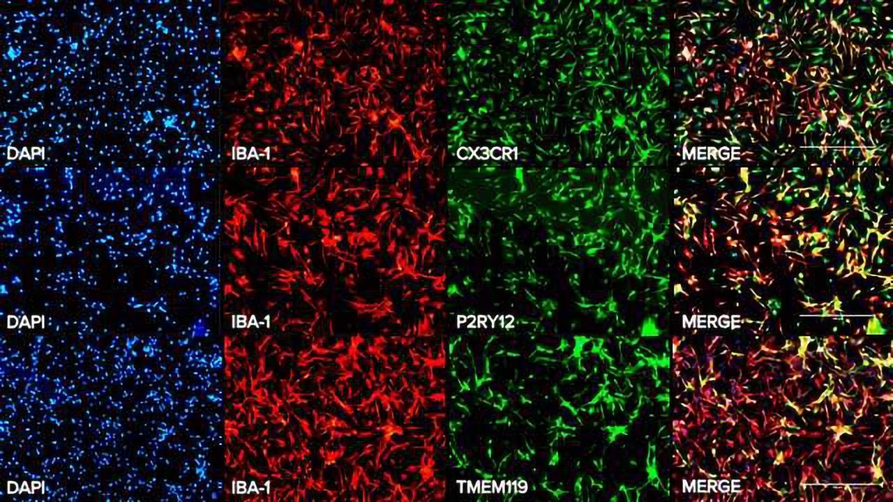 Axol Bioscience Launches Human iPSC-derived Microglia