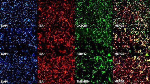 Axol Bioscience Launches Human iPSC-derived Microglia