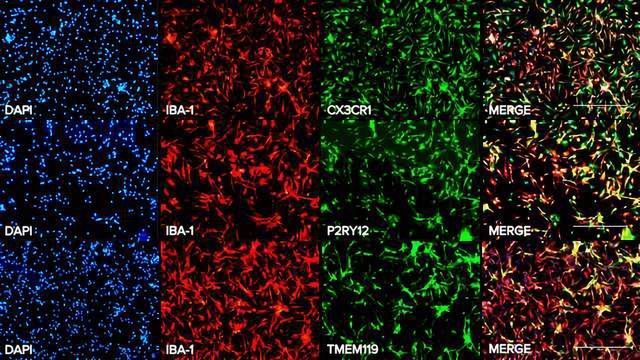 Axol生物科学发射人类iPSC-derived小胶质细胞内容块的形象