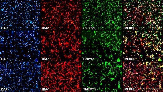 Axol Bioscience Launches Human iPSC-derived Microglia content piece image 