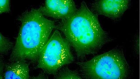Inhalable Form of mRNA to Help Treat Lung Diseases