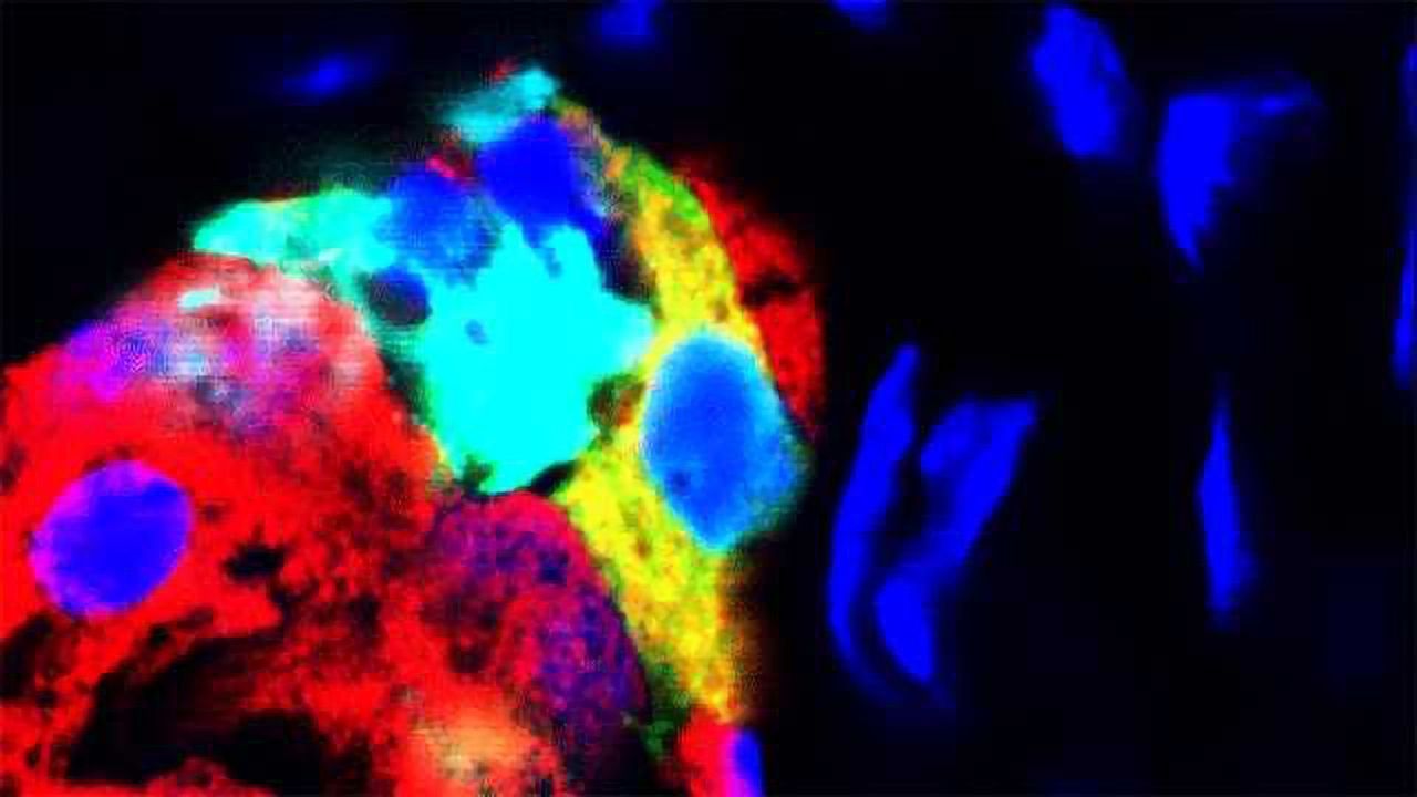 Glucagon-producing Cells Forced to Produce Insulin: New Therapeutic Approach for Diabetes?