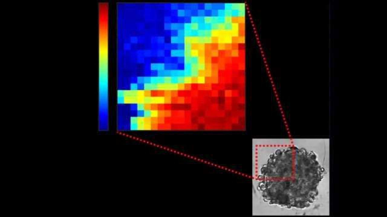 Exploring the Inside of Tumors with Physics