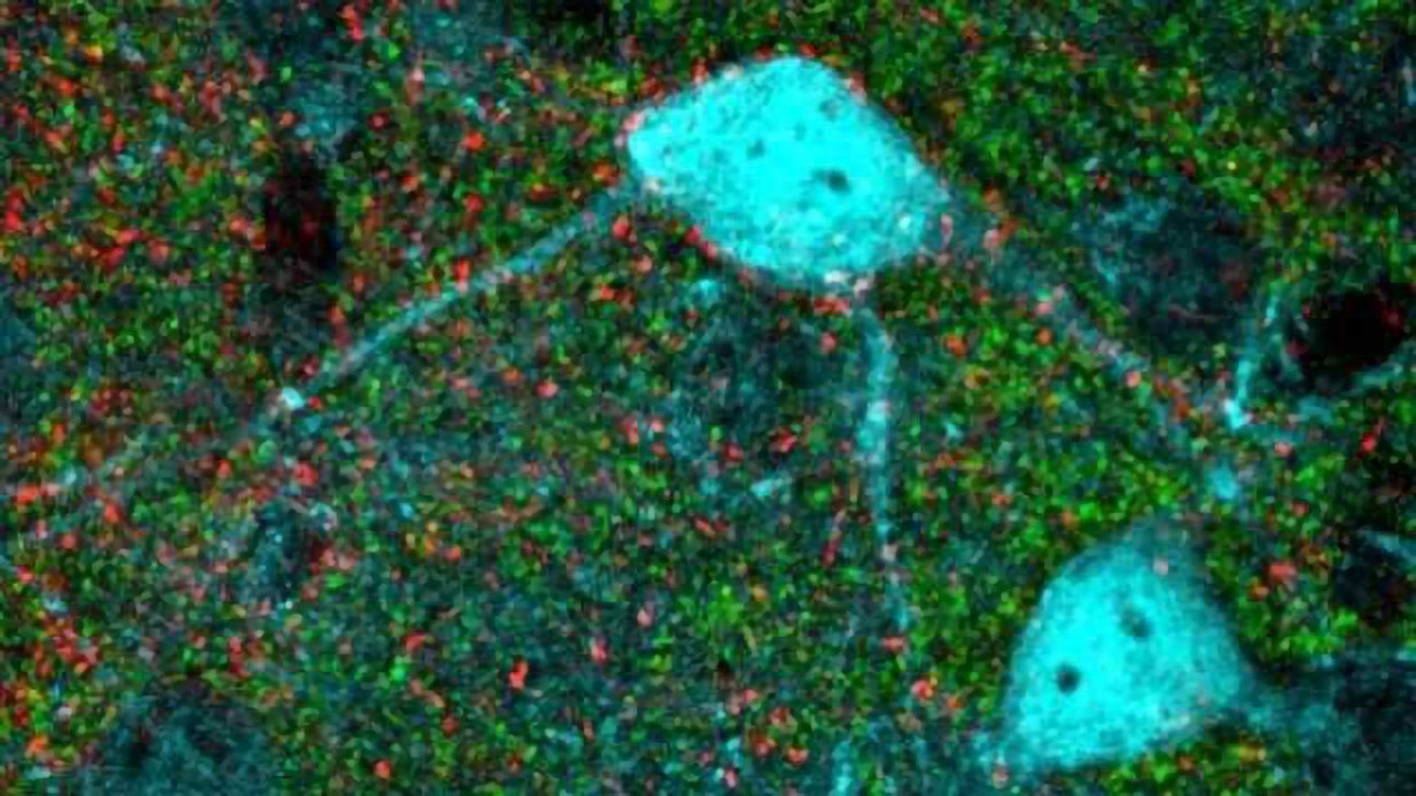 Bringing Plasticity Back to the Brain