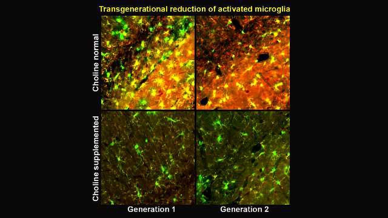 Essential Nutrient Tackles Alzheimer's Symptoms Across Generations in Mice