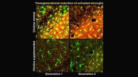 Essential Nutrient Tackles Alzheimer's Symptoms Across Generations in Mice