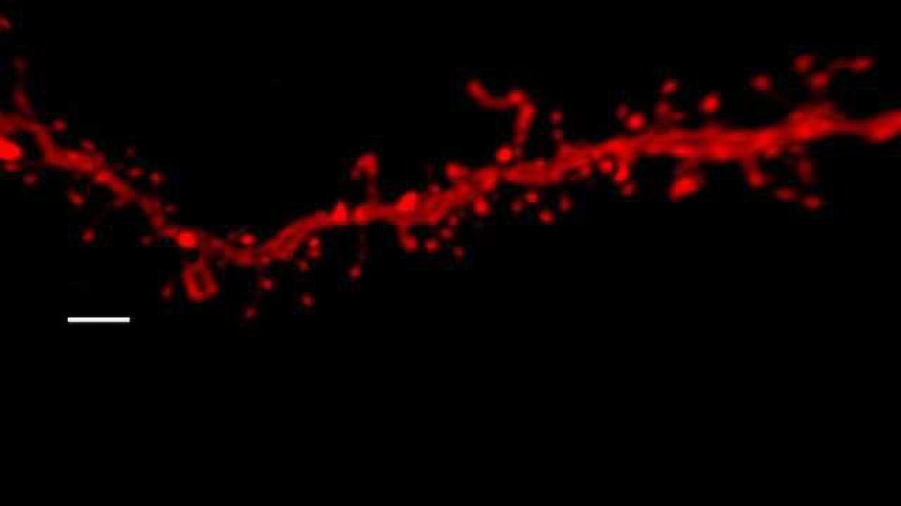 A Combination of THC and Stress in Adolescent Mice Linked to Anxiety Disorders