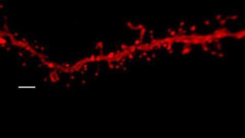 A Combination of THC and Stress in Adolescent Mice Linked to Anxiety Disorders