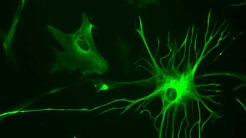 Keeping Time in the Brain
