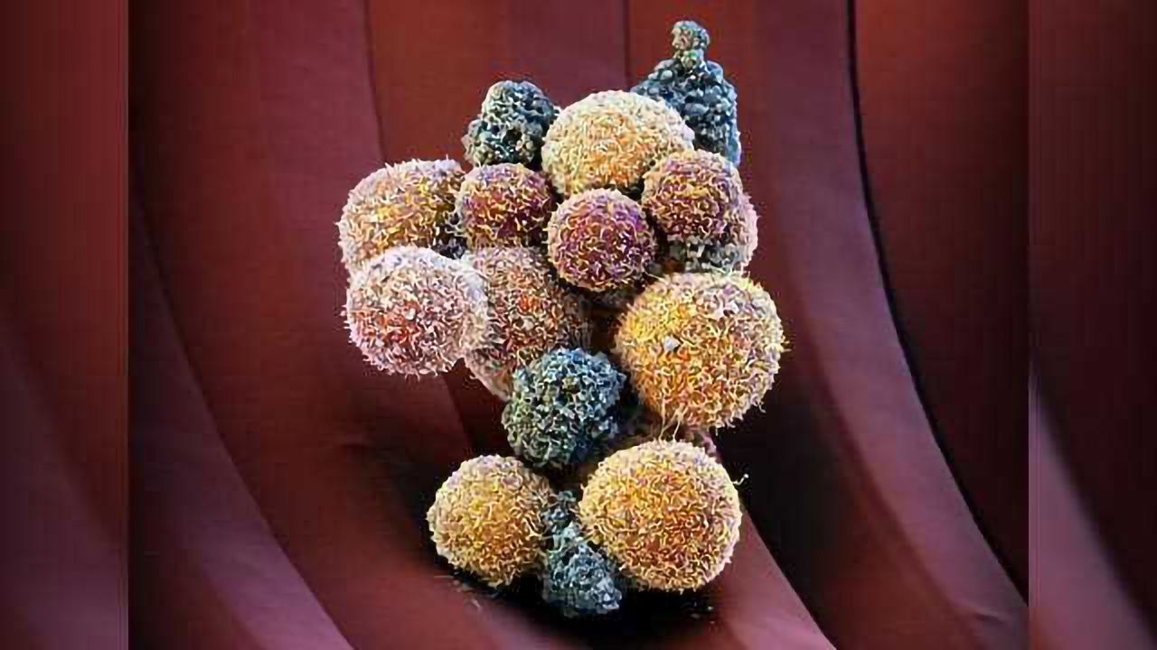 Drug Suppresses Formation of Metastases