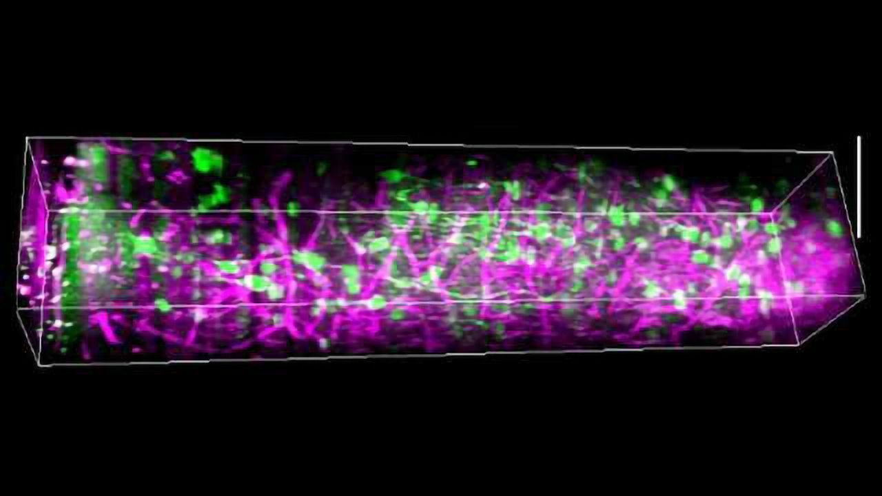 A Pioneering Peek into the Awake Brain