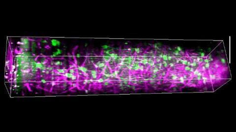 A Pioneering Peek into the Awake Brain