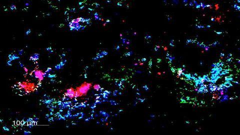 Novel Tumour Suppressor Protein Could Impact Breast Cancer Therapy