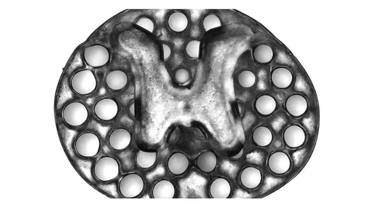 3D-Printed Implants Treat Spinal Cord Injury in Rats