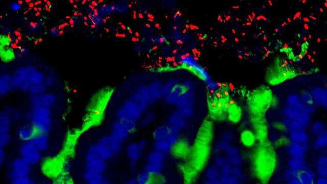 Could Gut Microbes from Healthy Infants Treat Milk Allergy?