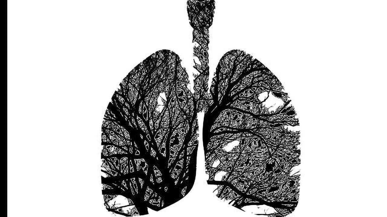 Costs and Complications of Lung Cancer Diagnostic Tests Underestimated