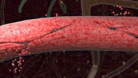 Blood-brain Barrier Breakdown Early Marker of Human Cognitive Dysfunction