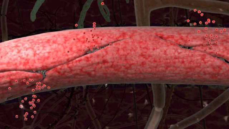 Bloodbrain Barrier Breakdown Early Marker of Human Cognitive