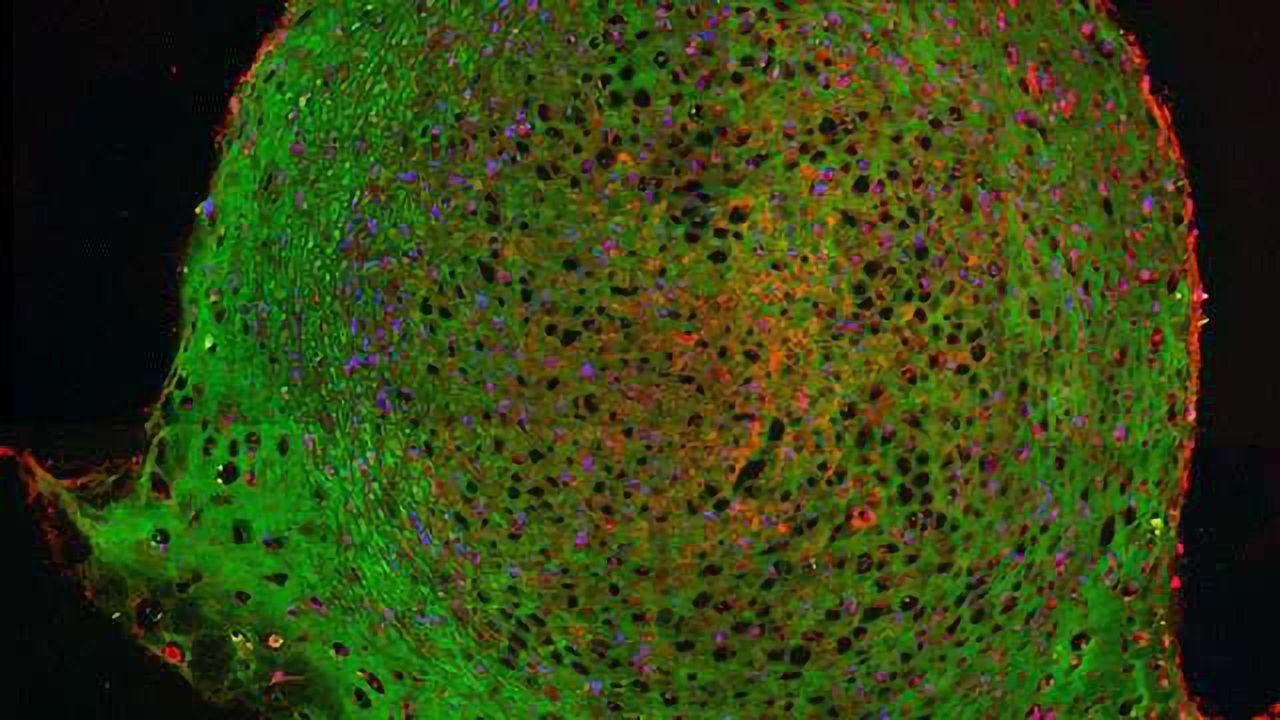 Stem Cells Regulate Their Fate by Altering Their Stiffness