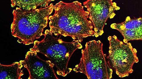 Hindering Melanoma Metastasis with FDA-approved Drug
