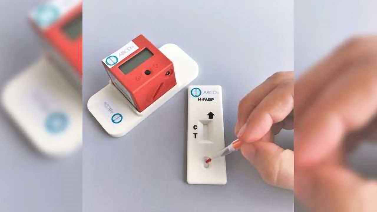 Biomarkers and a 90s Party - What's the Connection?