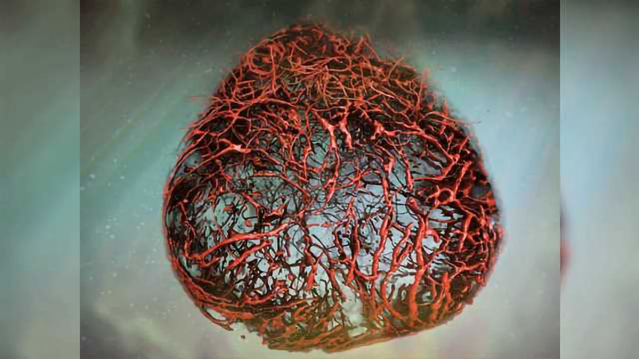 Human Blood Vessels Organoids a Model for Diabetes Research